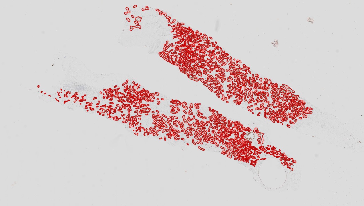 Annotated pathology slide